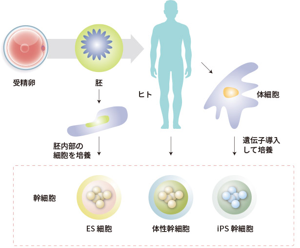 3種類の幹細胞の特徴（メリット・デメリット）